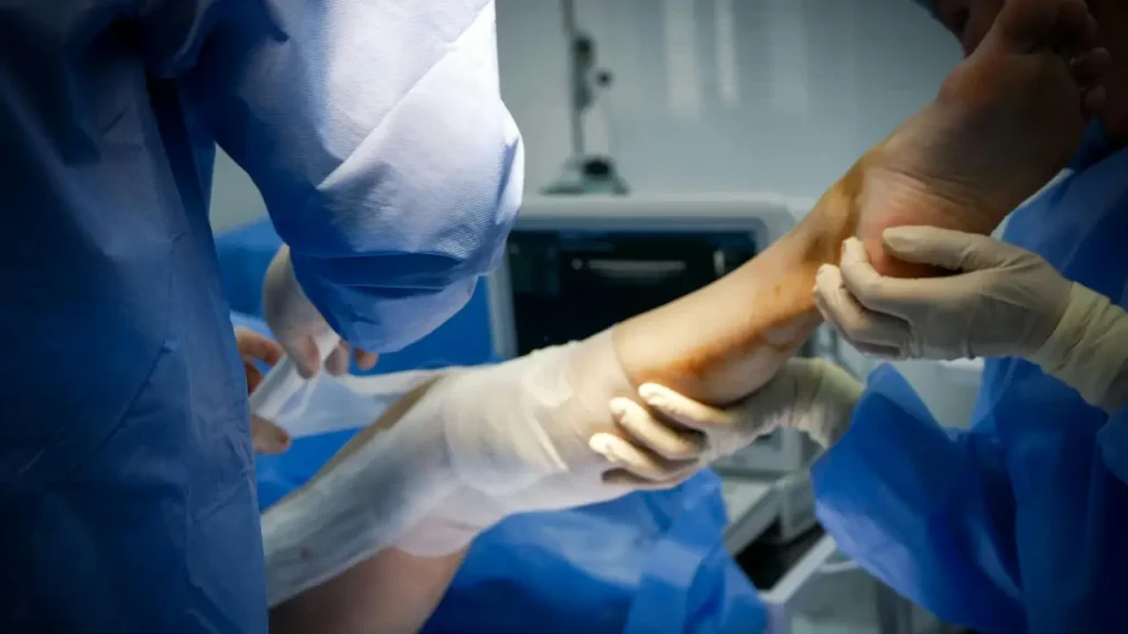 ACL Injury Treatment Options 4 Chirurgical therapy
